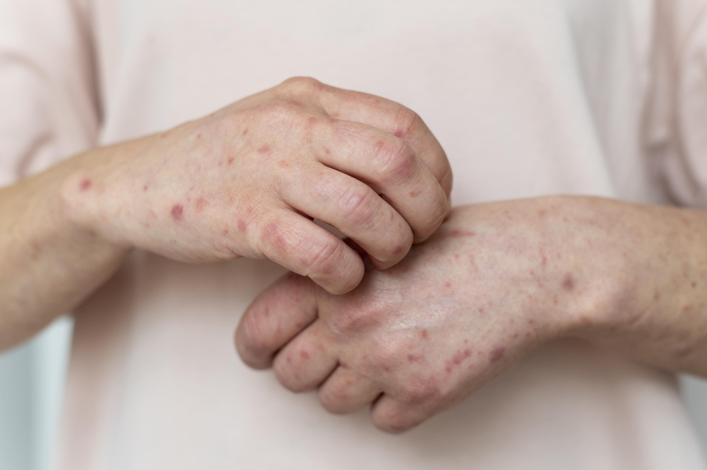 skin-allergy-person-s-arm.jpg skin-allergy-person-s-arm.jpg