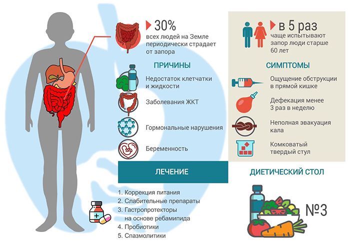 Причины, симптомы, лечение запора