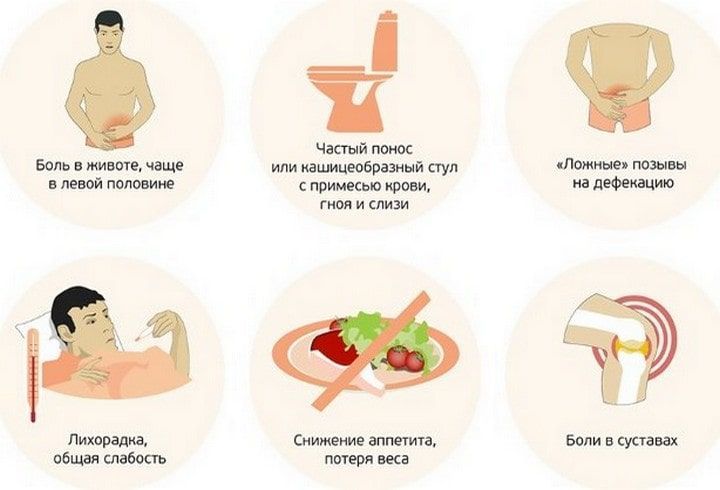Симптомы колита Симптомы колита