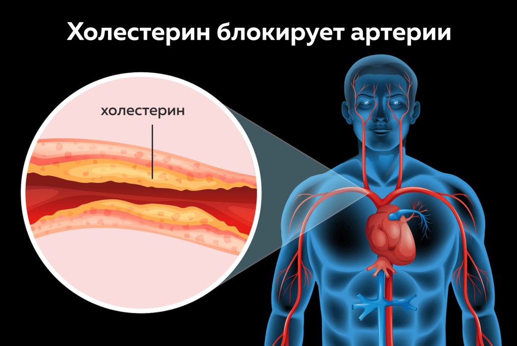 холестерин.png