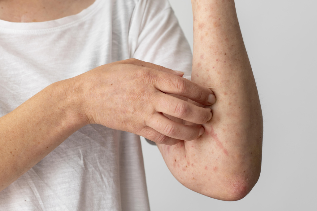 skin-allergy-reaction-person-s-arm (1).jpg