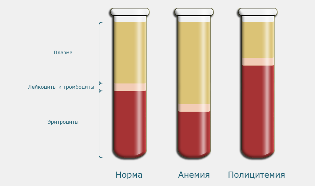 Расшифровка анализа СОЭ