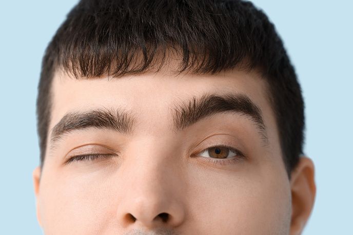 Почему дергается глаз: основные причины и что делать